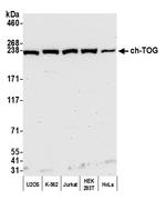 ch-TOG Antibody in Western Blot (WB)