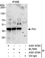 PA1 Antibody in Immunoprecipitation (IP)