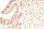 CKII beta Antibody in Immunohistochemistry (Paraffin) (IHC (P))