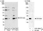 CKII beta Antibody in Western Blot (WB)