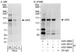 ARG Antibody in Western Blot (WB)