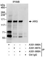 ARG Antibody in Immunoprecipitation (IP)