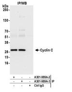 Cyclin C Antibody in Immunoprecipitation (IP)