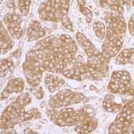 eIF3A/eIF3S10 Antibody in Immunohistochemistry (Paraffin) (IHC (P))