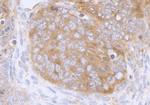 eIF3A/eIF3S10 Antibody in Immunohistochemistry (Paraffin) (IHC (P))