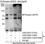 Phospho-ZAP70 (Tyr319) Antibody in Immunoprecipitation (IP)