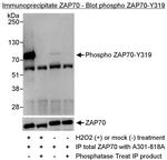 Phospho-ZAP70 (Tyr319) Antibody in Immunoprecipitation (IP)