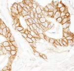 Beta-catenin Antibody in Immunohistochemistry (Paraffin) (IHC (P))