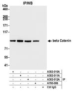 Beta-catenin Antibody in Immunoprecipitation (IP)