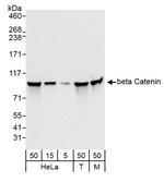 Beta-catenin Antibody in Western Blot (WB)