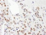 KSRP Antibody in Immunohistochemistry (Paraffin) (IHC (P))