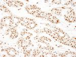 KSRP Antibody in Immunohistochemistry (Paraffin) (IHC (P))