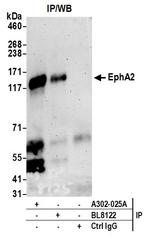 EphA2 Antibody in Immunoprecipitation (IP)