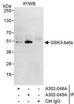 GSK3-beta Antibody in Immunoprecipitation (IP)