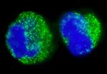 BCR Antibody in Immunocytochemistry (ICC/IF)