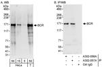 BCR Antibody in Western Blot (WB)