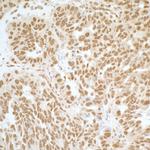 Phospho-RelA (Ser536) Antibody in Immunohistochemistry (Paraffin) (IHC (P))