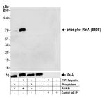 Phospho-RelA (Ser536) Antibody in Western Blot (WB)