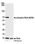 Phospho-RelA (Ser536) Antibody in Western Blot (WB)