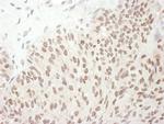 Phospho-RelA (Ser468) Antibody in Immunohistochemistry (Paraffin) (IHC (P))