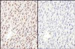 Phospho-RelA (Ser468) Antibody in Immunohistochemistry (Paraffin) (IHC (P))