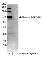 Phospho-RelA (Ser468) Antibody in Western Blot (WB)