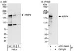 ARIP4 Antibody in Western Blot (WB)