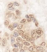 QSER1 Antibody in Immunohistochemistry (Paraffin) (IHC (P))