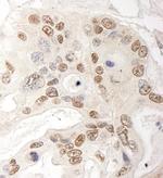 QSER1 Antibody in Immunohistochemistry (Paraffin) (IHC (P))