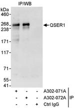 QSER1 Antibody in Immunoprecipitation (IP)