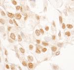 SRcyp Antibody in Immunohistochemistry (Paraffin) (IHC (P))