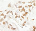 SRcyp Antibody in Immunohistochemistry (Paraffin) (IHC (P))