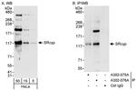 SRcyp Antibody in Western Blot (WB)