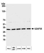 U2AF35 Antibody in Western Blot (WB)