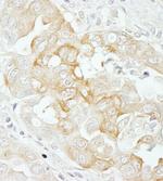 Notch2 Antibody in Immunohistochemistry (Paraffin) (IHC (P))