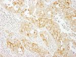 Notch2 Antibody in Immunohistochemistry (Paraffin) (IHC (P))