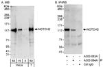 Notch2 Antibody in Western Blot (WB)