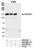 PRKCBP1 Antibody in Immunoprecipitation (IP)