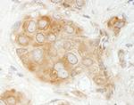 GIT1 Antibody in Immunohistochemistry (Paraffin) (IHC (P))