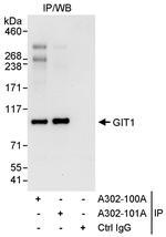 GIT1 Antibody in Immunoprecipitation (IP)