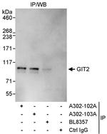 GIT2 Antibody in Immunoprecipitation (IP)