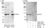 GIT2 Antibody in Western Blot (WB)