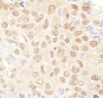 NF-YA Antibody in Immunohistochemistry (Paraffin) (IHC (P))