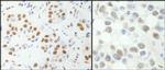 NF-YA Antibody in Immunohistochemistry (Paraffin) (IHC (P))