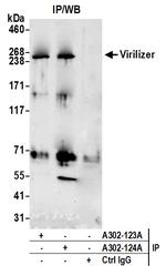 Virilizer Antibody in Immunoprecipitation (IP)