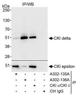 CKI delta Antibody in Immunoprecipitation (IP)