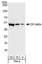 CKI delta Antibody in Western Blot (WB)