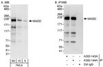 MADD Antibody in Western Blot (WB)