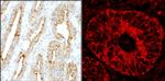 MADD Antibody in Immunohistochemistry (Paraffin) (IHC (P))