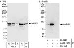 NARG1 Antibody in Western Blot (WB)